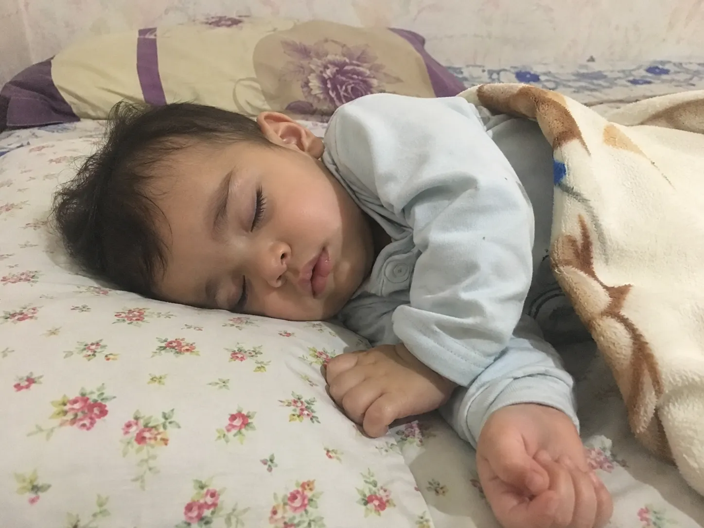 مراقبت از نوزاد پس از ختنه با رینگ حلقه